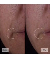 philosophy Dose Of Wisdom Bouncy Skin Reactivating Serum