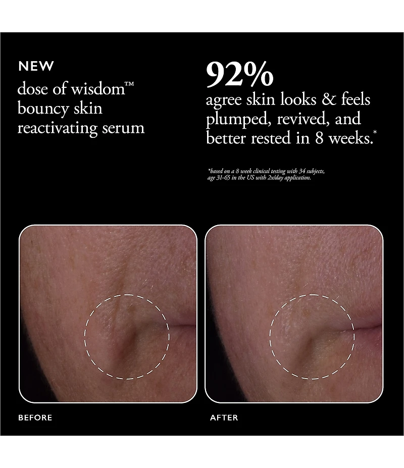 philosophy Dose Of Wisdom Bouncy Skin Reactivating Serum