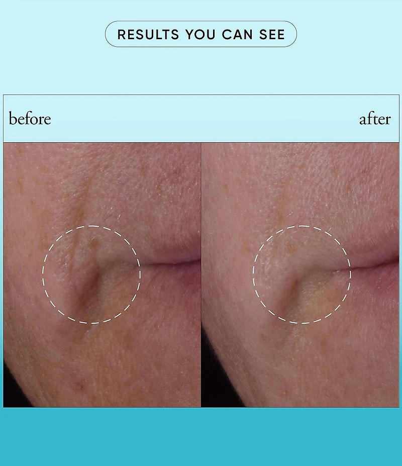 philosophy Dose Of Wisdom Bouncy Skin Reactivating Serum