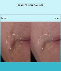 philosophy Dose Of Wisdom Bouncy Skin Reactivating Serum