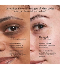 philosophy Dose Of Wisdom Dark Circle Brightening Eye Cream