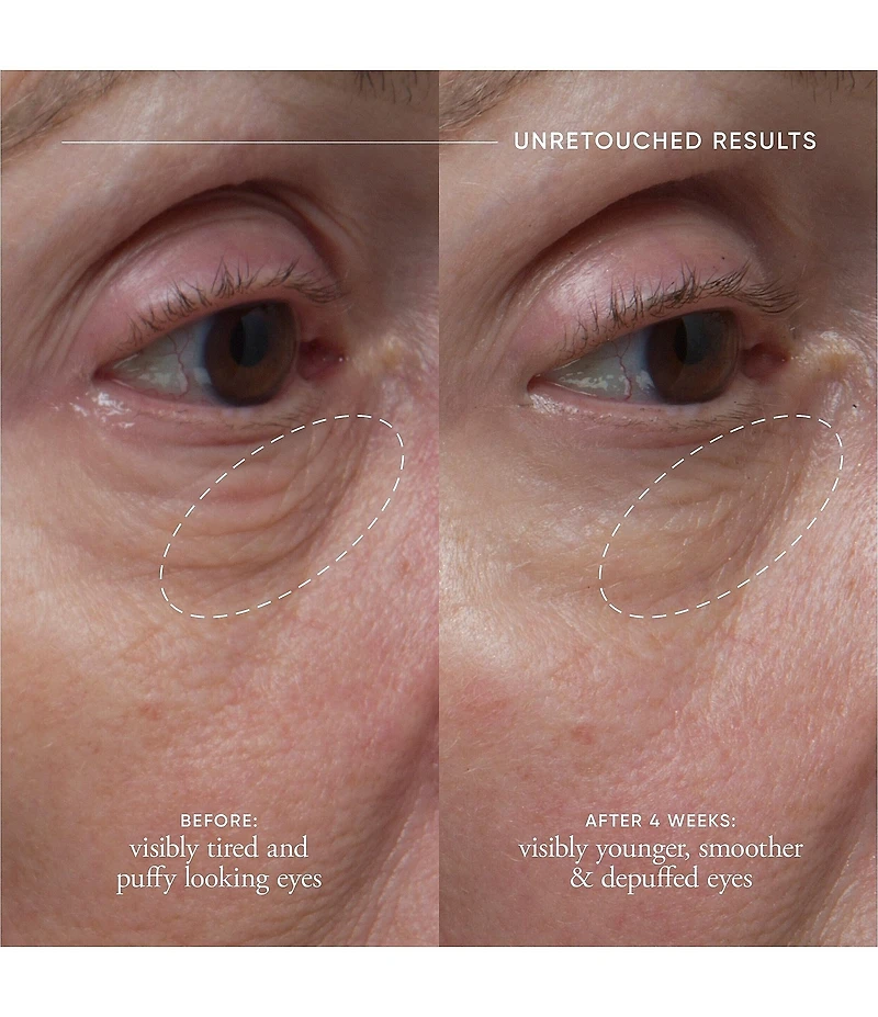 philosophy Dose Of Wisdom Dark Circle Brightening Eye Cream