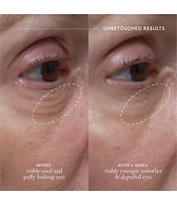 philosophy Dose Of Wisdom Dark Circle Brightening Eye Cream