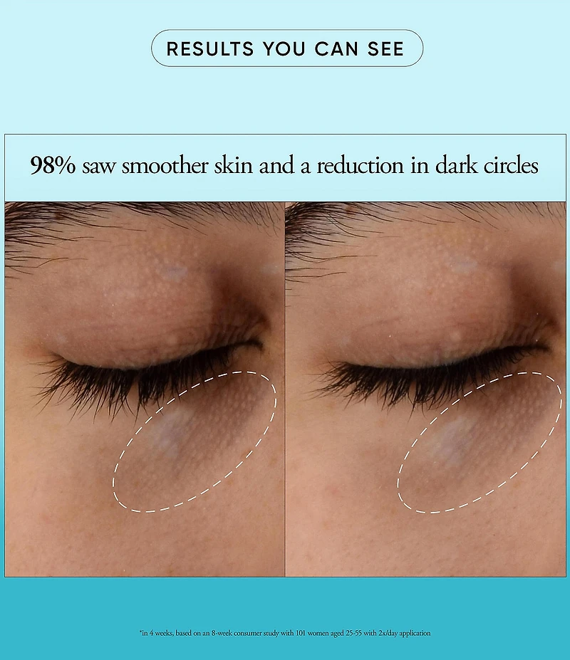 philosophy Dose Of Wisdom Dark Circle Brightening Eye Cream