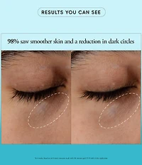 philosophy Dose Of Wisdom Dark Circle Brightening Eye Cream