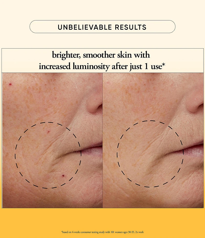 Philosophy The Microdelivery Resurfacing Peel Kit