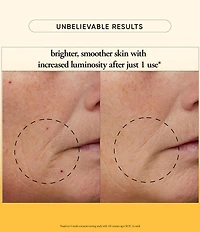 Philosophy The Microdelivery Resurfacing Peel Kit