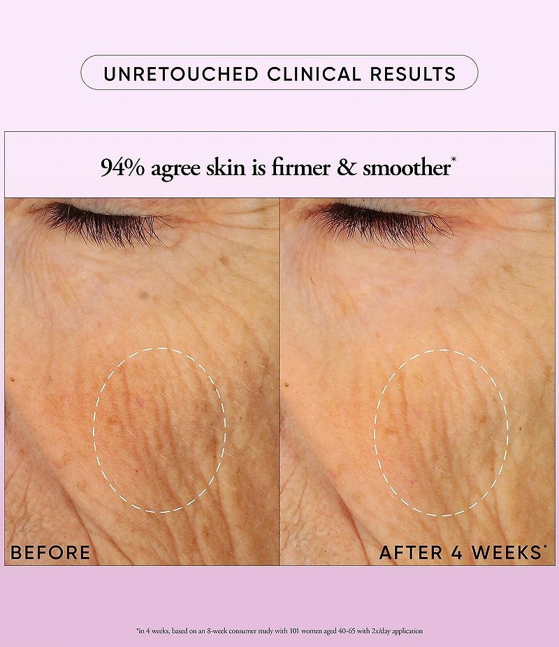 philosophy ultimate miracle worker nourish & rejuvenate face & neck moisturizer