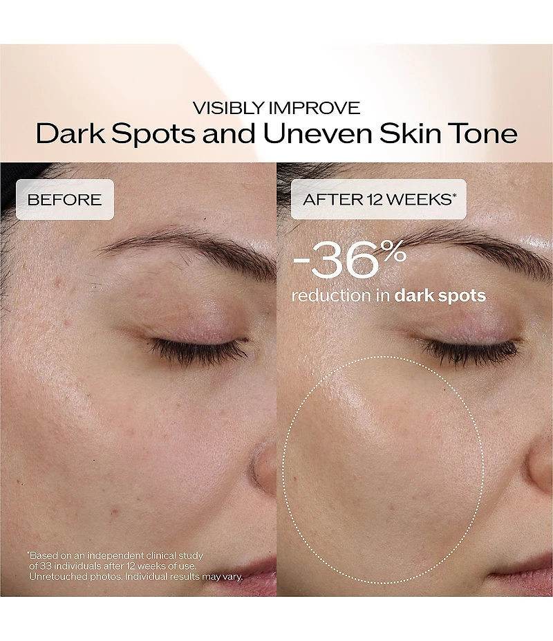 Shiseido Benefiance Dark Spot and Wrinkle Smoothing Serum