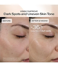 Shiseido Benefiance Dark Spot and Wrinkle Smoothing Serum