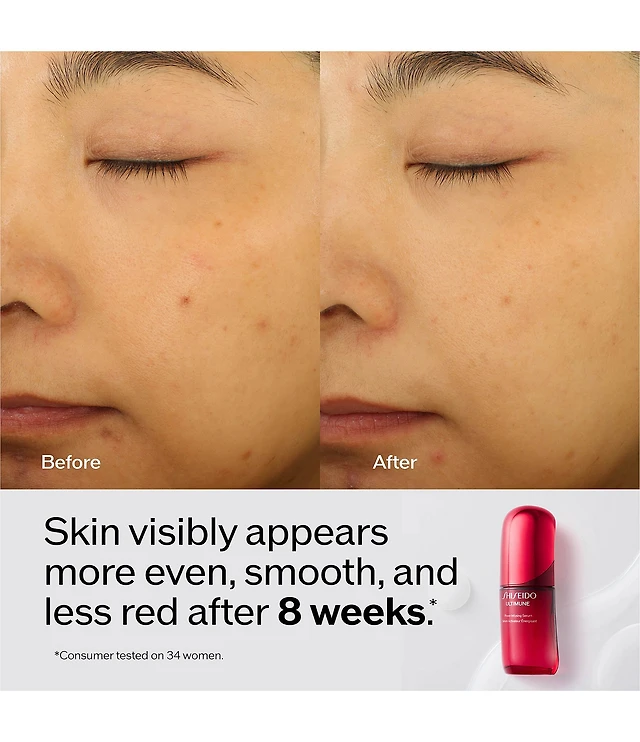 Shiseido Ultimune Strengthening Serum Set