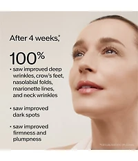 Shiseido Vital Perfection Intensive WrinkleSpot Treatment A+