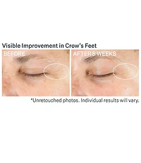 StriVectin Advanced Retinol Multi-Correct Eye Cream