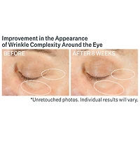 StriVectin Advanced Retinol Multi-Correct Eye Cream