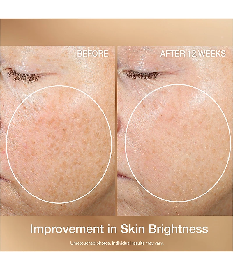 StriVectin Jumbo Super C Retinol Brighten & Correct Vitamin C Serum