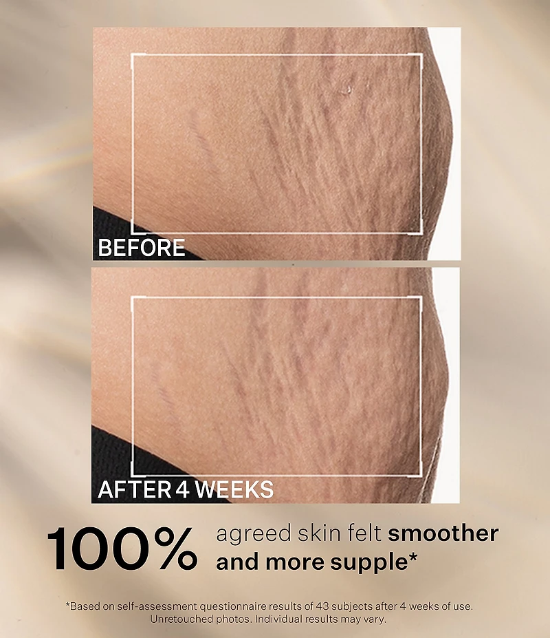 Strivectin SD Advanced Plus Intensive Moisturizer