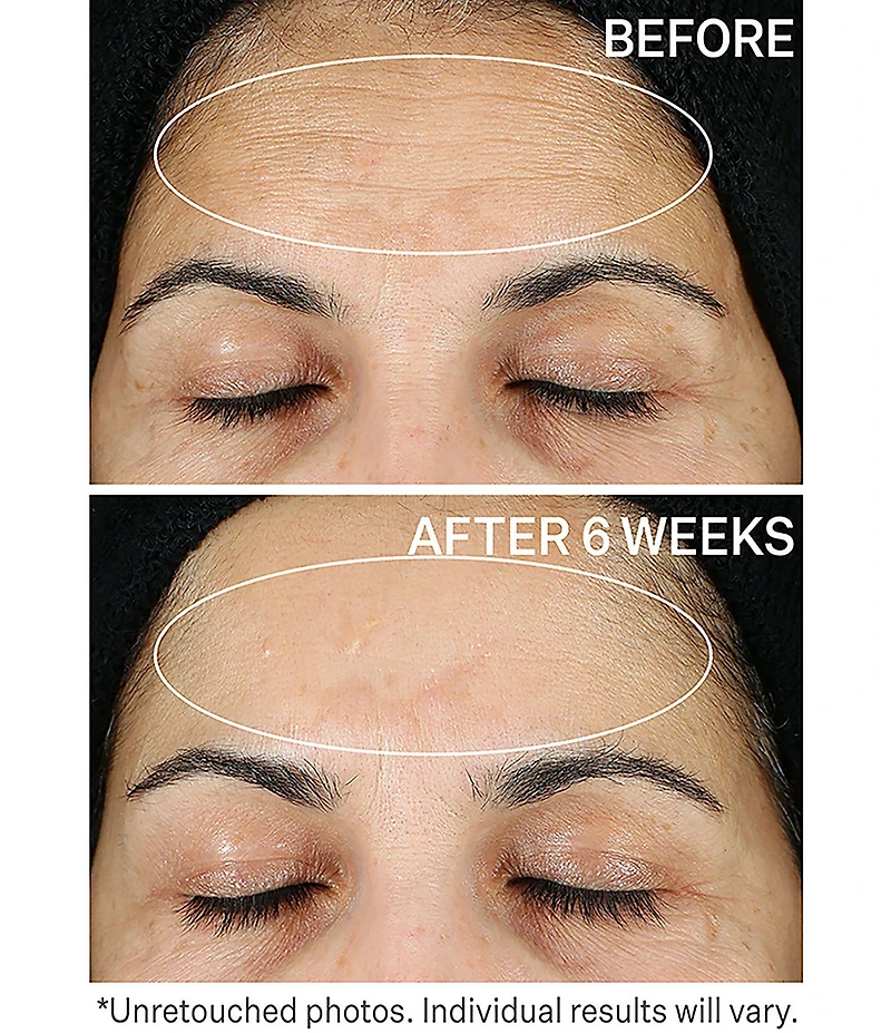 StriVectin SUPER-C RETINOL Brighten & Correct Vitamin C Serum