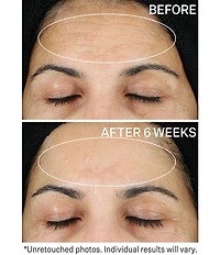 StriVectin SUPER-C RETINOL Brighten & Correct Vitamin C Serum