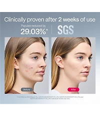 ULIKE ReGlow LED Light Therapy Mask