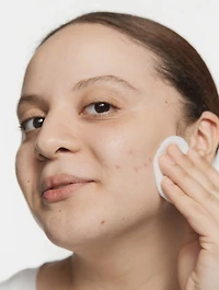 Acne Solutions Clarifying Lotion