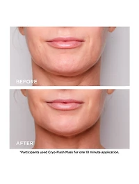 Cryo-Flash Cream-Mask