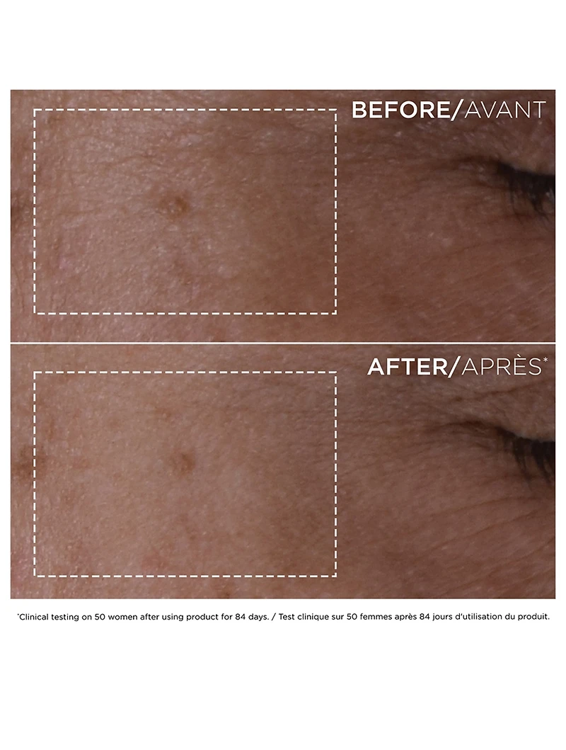 Double Serum