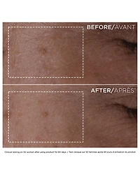 Double Serum
