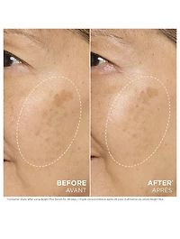 Bright Plus [Advanced] Serum