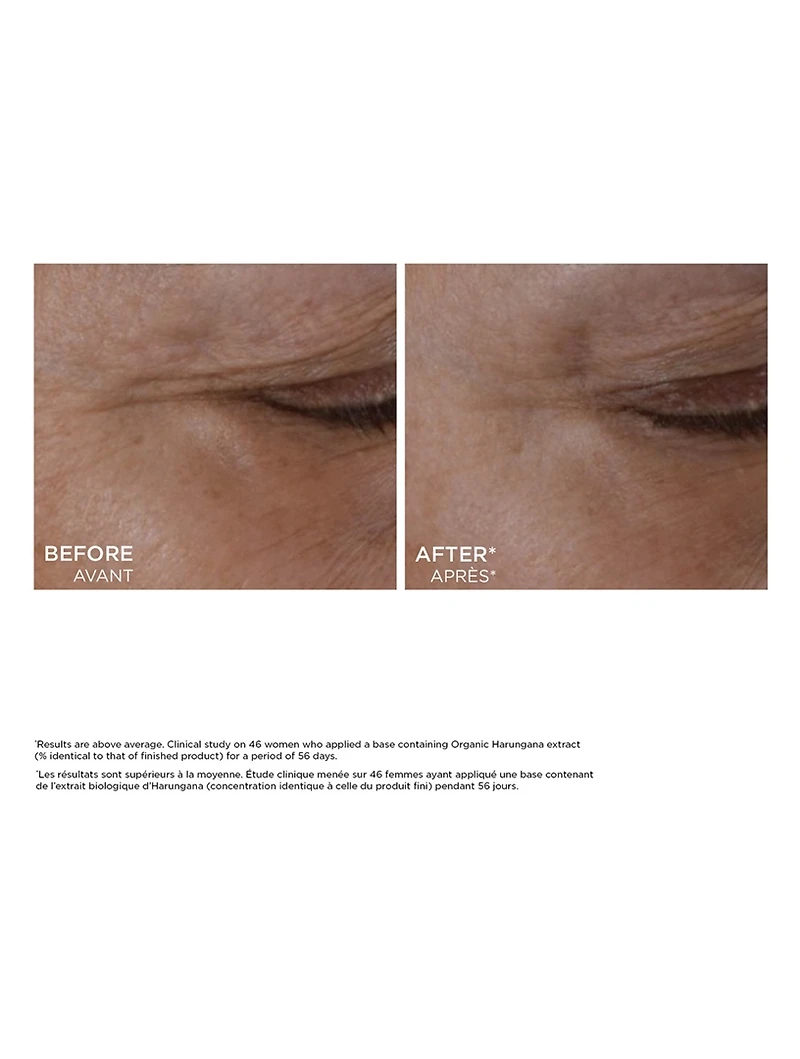 Total Eye Lift Refill