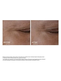Total Eye Lift Refill