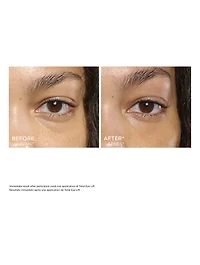 Total Eye Lift Refill