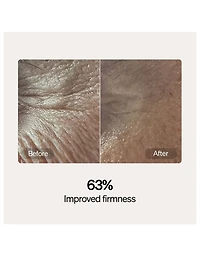 Skincare Serum and Cream Starter Kit