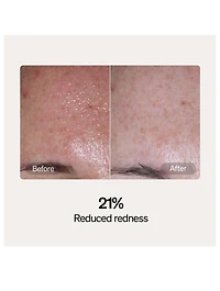 Skincare Serum and Cream Starter Kit