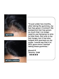Nourish Haircare Gummies