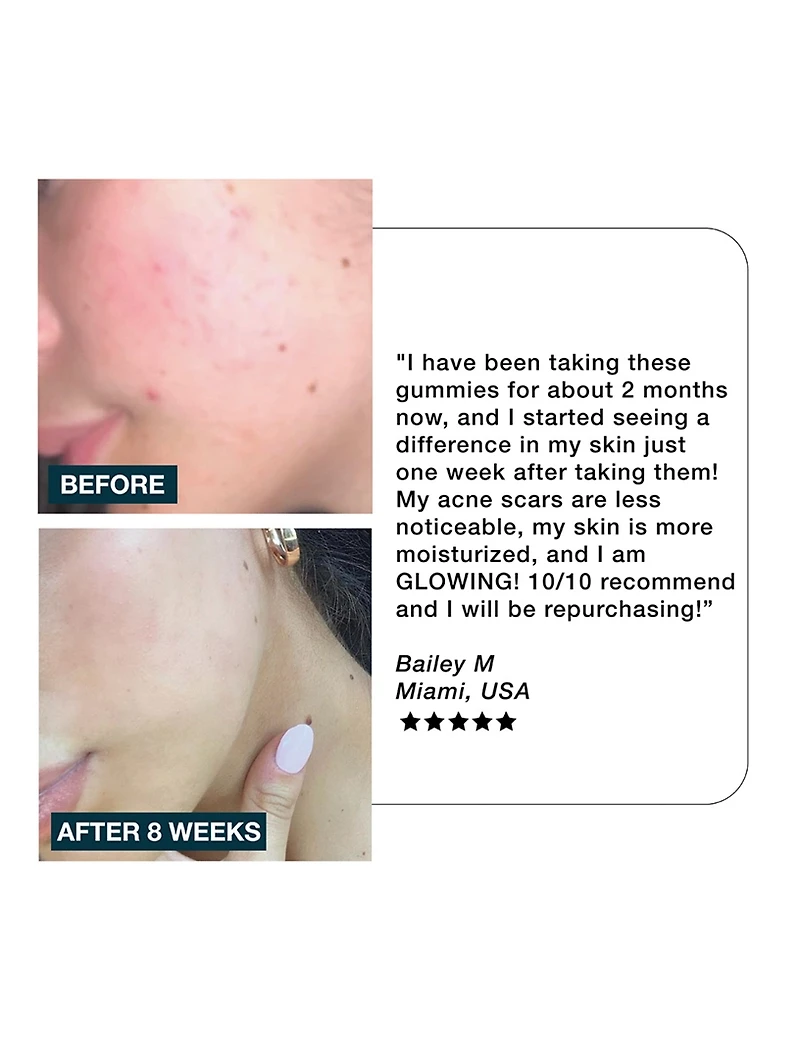 Glow Skincare Gummies