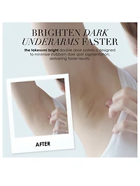 The Brightening Bar