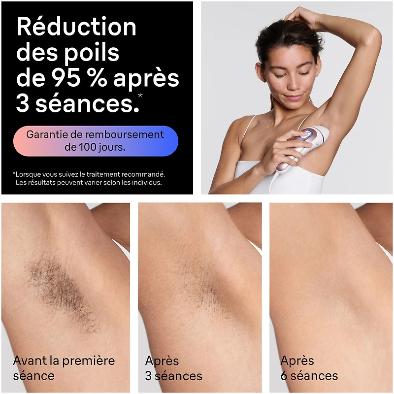Braun Skin i-Expert Smart IPL PL7243 at Home Laser Hair Removal for Women and Men with App, Premium Pouch, 3 heads, Venus Razor