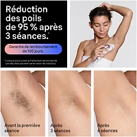 Braun Skin i-Expert Smart IPL PL7243 at Home Laser Hair Removal for Women and Men with App, Premium Pouch, 3 heads, Venus Razor