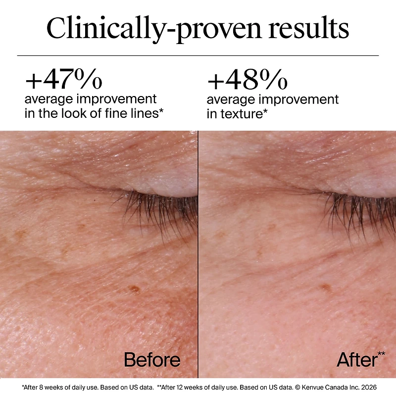 Neutrogena Rapid Wrinkle Repair Regenerating Cream - Retinol Face & Eye Moisturizer - Hyaluronic Acid Serum- 48 mL