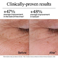 Neutrogena Rapid Wrinkle Repair Regenerating Cream - Retinol Face & Eye Moisturizer - Hyaluronic Acid Serum- 48 mL