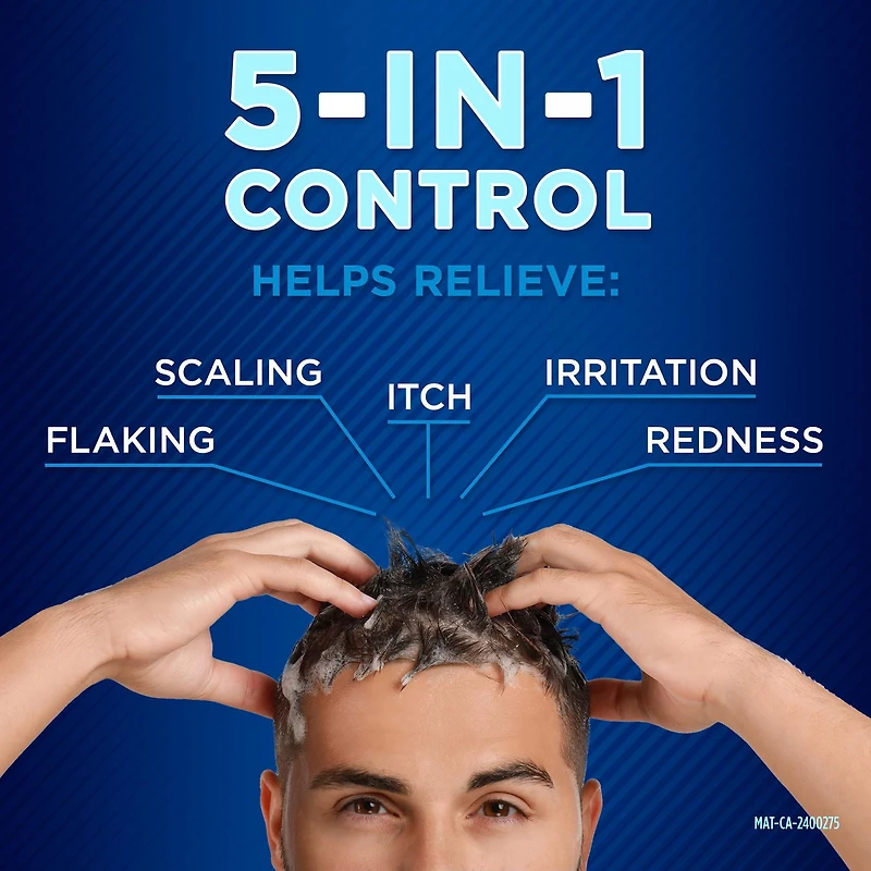 Selsun Blue 2.5% Extra Strength Anti-Dandruff Shampoo, Clinically Proven Selenium Sulfide, Dandruff Treatment, Seborrhea and Tinea Versicolor, Vitamin B3 to Promote Healthy Looking Hair, 250mL, 250mL