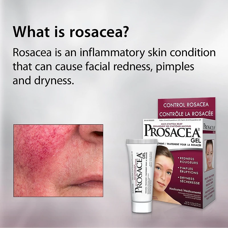 Prosacea Rosacea Treatment Gel