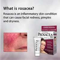Prosacea Rosacea Treatment Gel