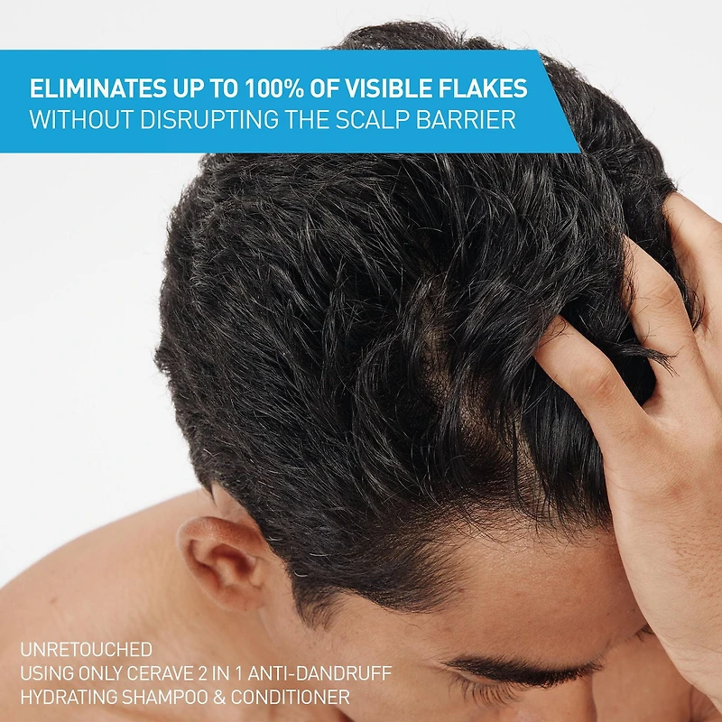 CeraVe 2-in-1 Anti Dandruff Hydrating Shampoo and Conditioner for Men & Women, Gently Cleanses Scalp & Hair While Reducing Flakes, Itchiness, and Irritation, 355mL, Reduces dandruff flakes