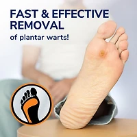 Gel Pour Enlever Les Verrues Plantaires Dr. Scholl’s, 16 disques
