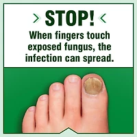 Fungicure Anti-Fungal Liquid Topical Formula Maximum Strength, 30 mL