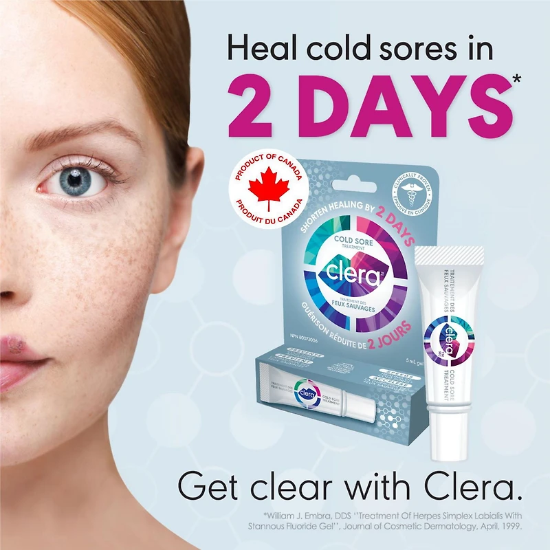 CLERA Cold Sore Treatment. Heals your cold sore in 2 days. Clinically proven. 5 ml
