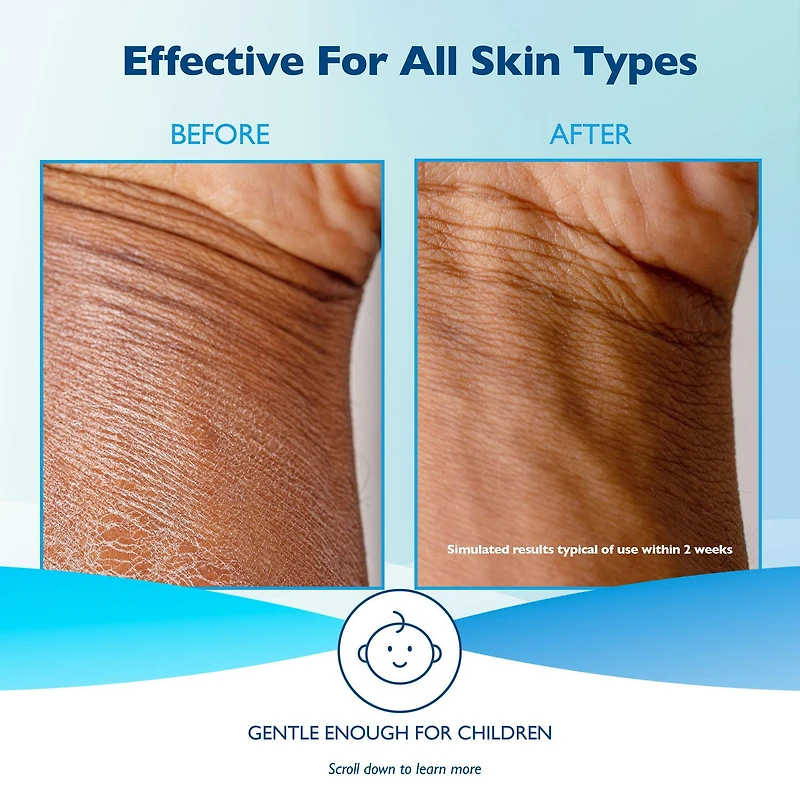 Glaxal Base Sensitive Skin Moisturizing Cream, Relieves Dry, Chapped and Rough Skin, 450g