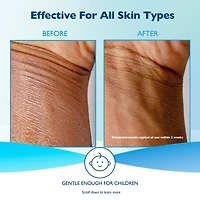 Glaxal Base Sensitive Skin Moisturizing Cream, Relieves Dry, Chapped and Rough Skin, 450g