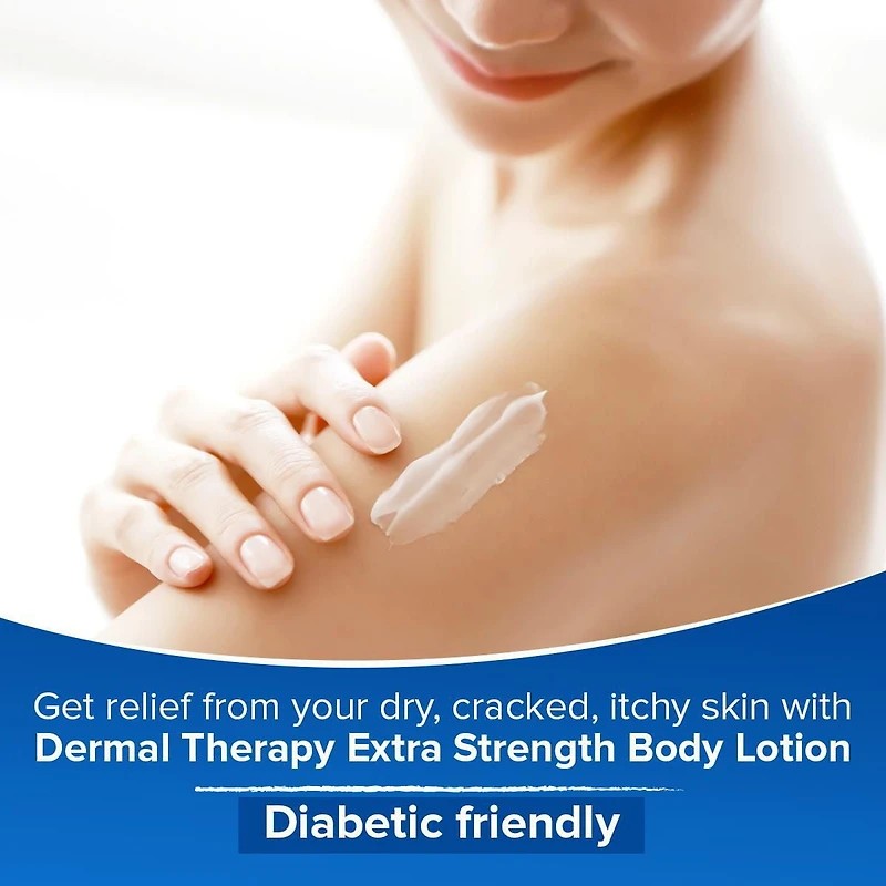 Dermal Therapy™ Extra Strength Body Lotion, 240 ml